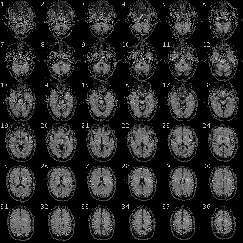 Thirty-six axial slices of a functional MRI scan of a human brain